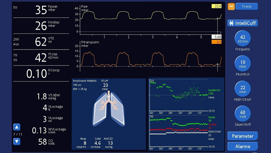 Screenshot showing IntelliCuff set to manual