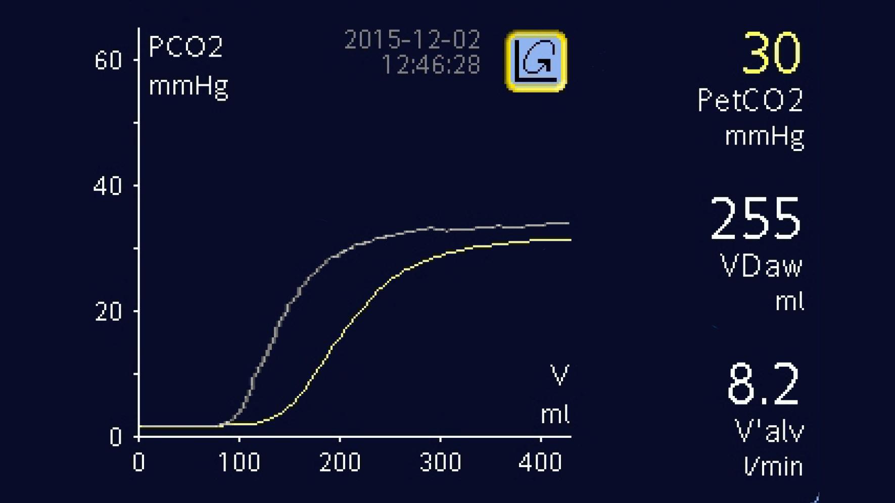 Volumetric Capnography