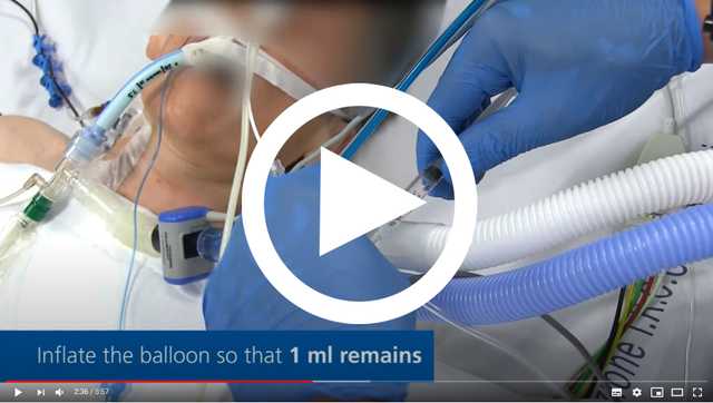 P01_Esophageal_Catheter_Placement_Video