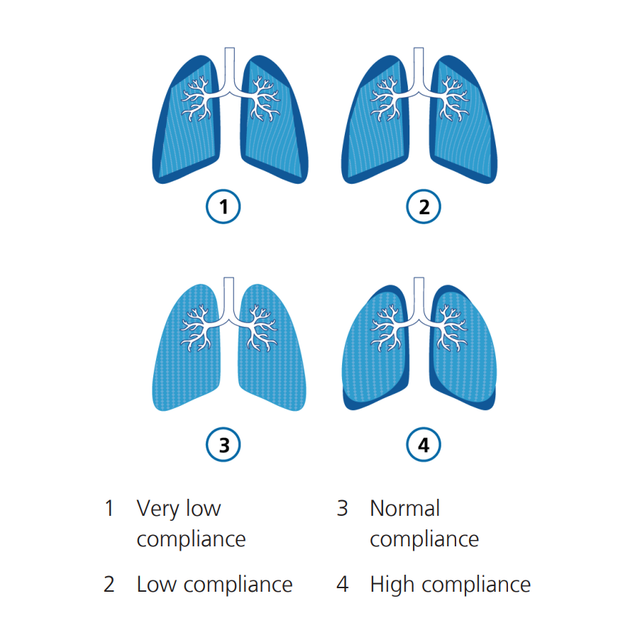 Ilustración gráfica: compliance del pulmón dinámico