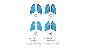 Graphic illustration: Dynamic lung compliance