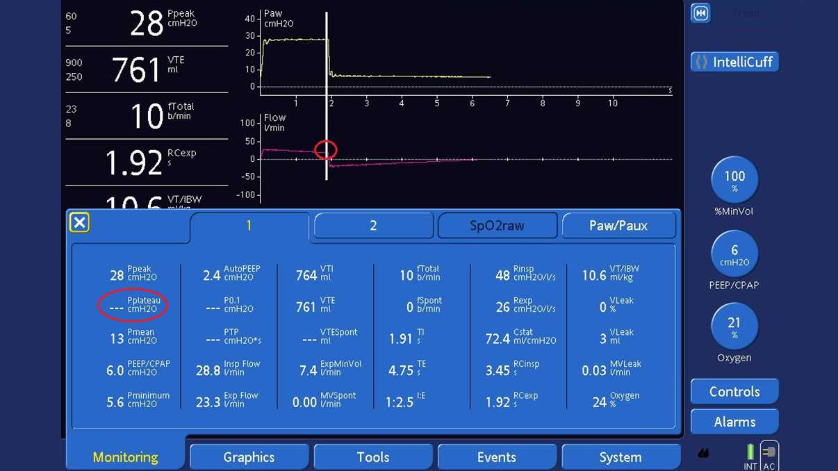 Schermo del ventilatore con Pplateau non visualizzata