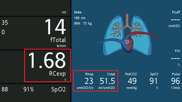 Screenshot of display showing RCexp of 1.68