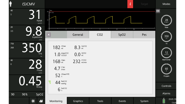 Captura de pantalla donde se muestran los parámetros de CO2