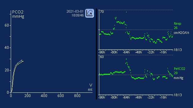 Снимок экрана, на котором изображены графики сопротивления потоку на вдохе («Rинсп») в сравнении с PetCO2.