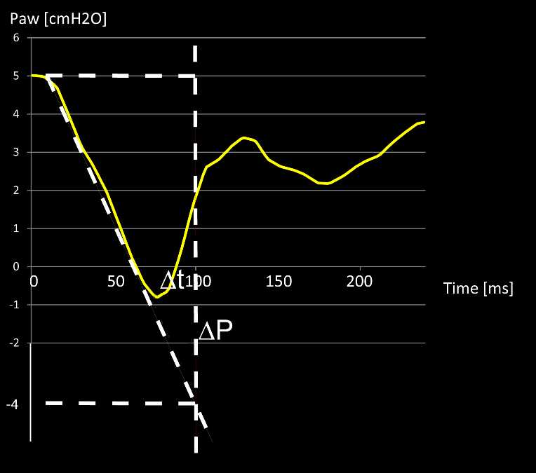 Screenshot showing pressure drop below PEEP within first 100 ms marked with dotted line