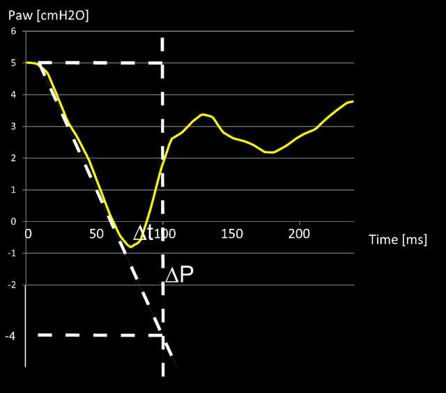 Screenshot showing pressure drop below PEEP within first 100 ms marked with dotted line