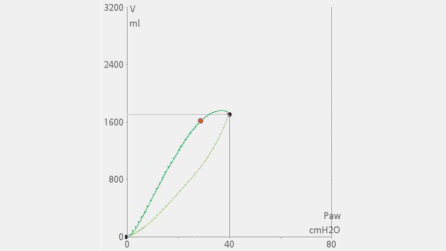 P/V loop showing immediate volume increase