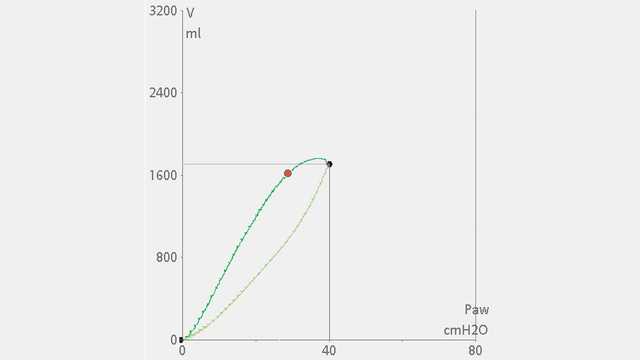 Detecting complete airway closure in mechanically ventilated patients