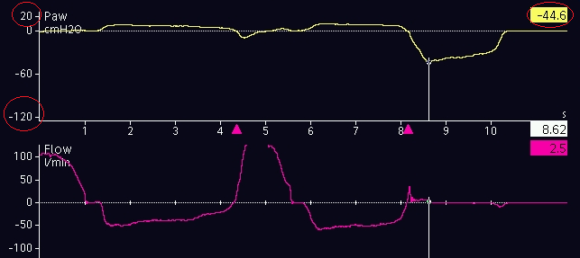 Screenshot showing measurement of pressure curve minimum