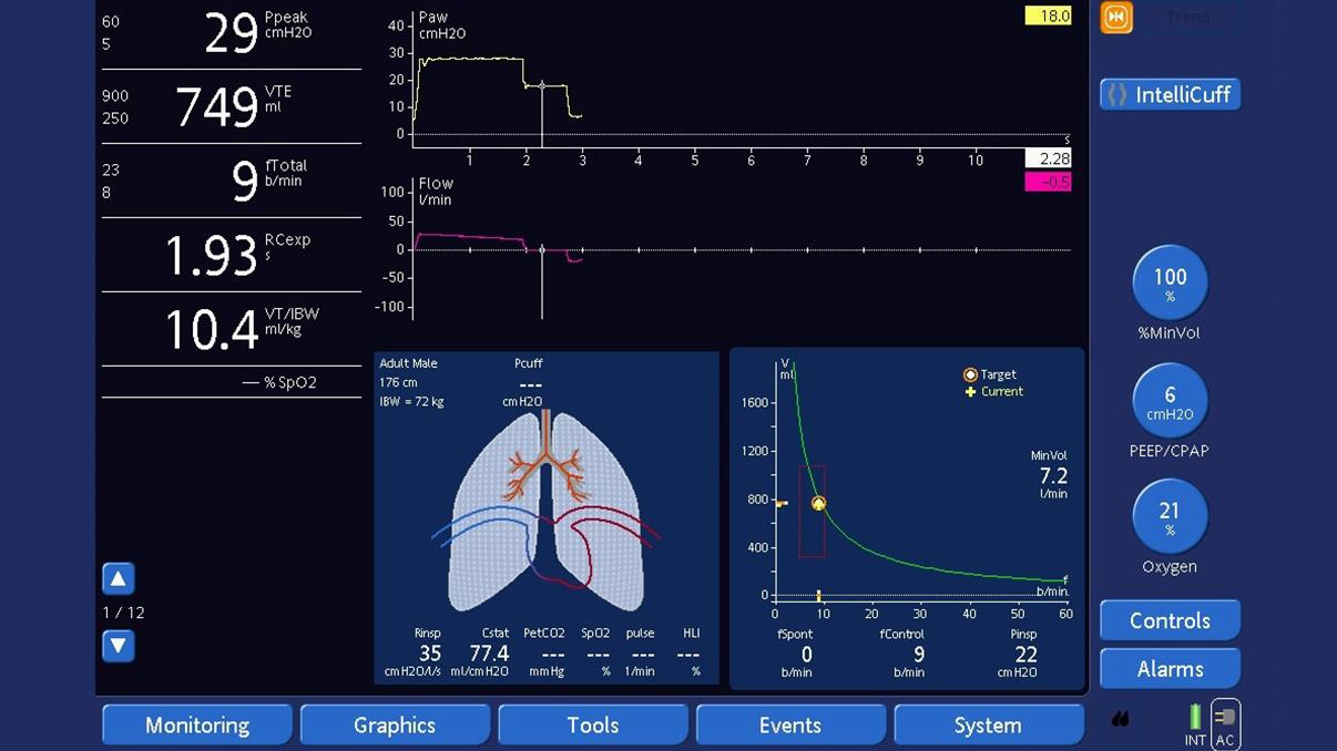 Measured values for Ppeak and Pplateau Hamilton Medical