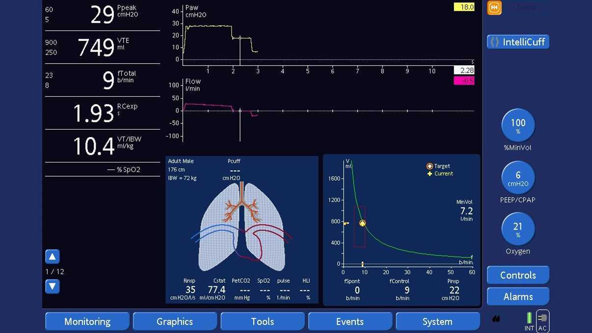 Schermata del ventilatore con la manovra di pausa inspiratoria visualizzata