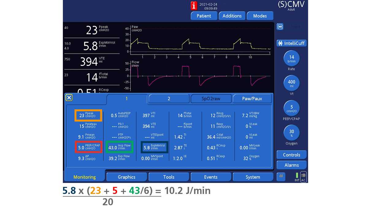 Screenshot showing relevant parameters for calculating MP in volume control in monitoring window