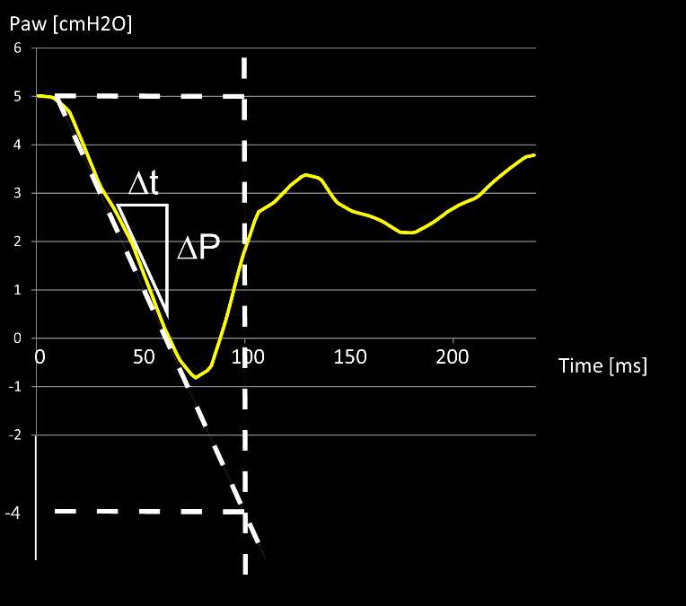 Screenshot showing steepest tangent of drop in Paw as white triangle