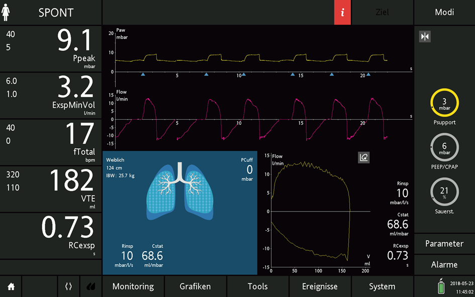 Screen showing monitoring parameters and waveforms