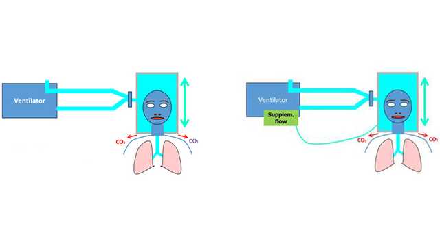 Diagram - supplemental flow if CO2 rebreathing suspected