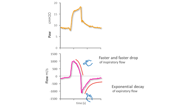 Diagrams representing pressure and flow waveforms showing end of inspiration