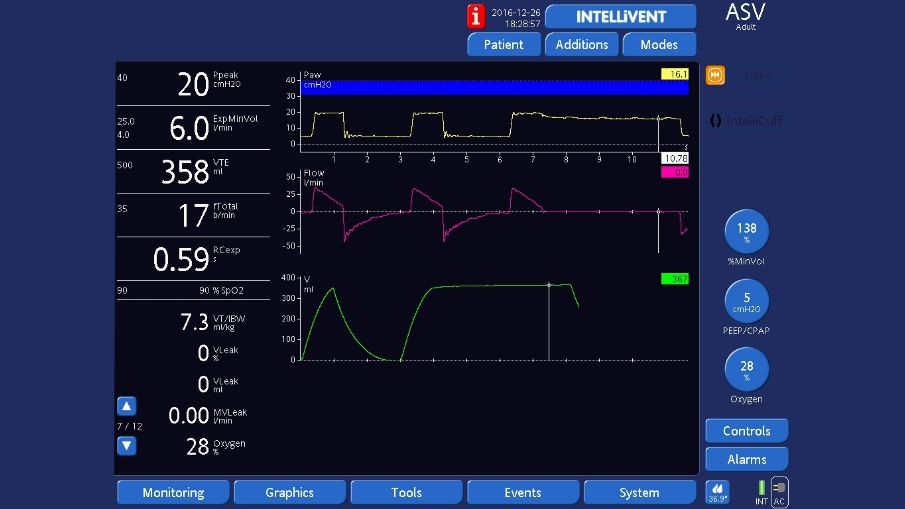 Screenshot ventilator display showing end-inspiratory hold in ASV mode