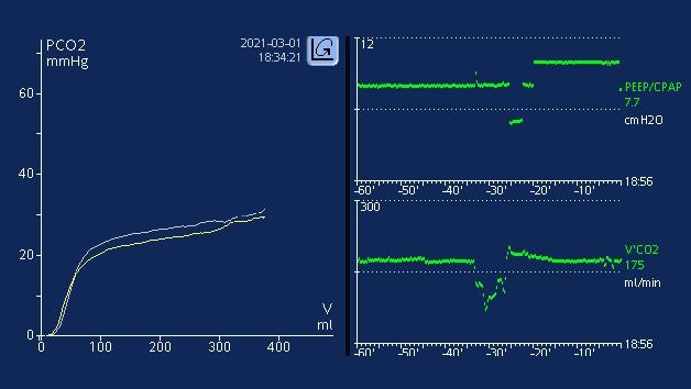 Screenshot showing graphs of PEEP/CPAP vs. V’CO2