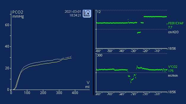 显示 PEEP/CPAP 与 V’CO2 图的截图