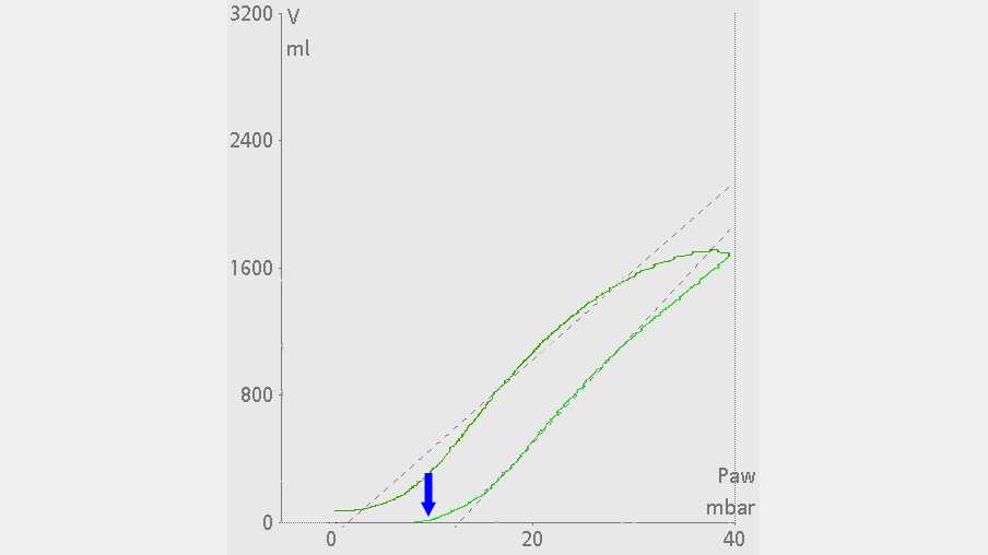 P/V loop with no volume increase