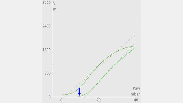 P/V loop with no volume increase