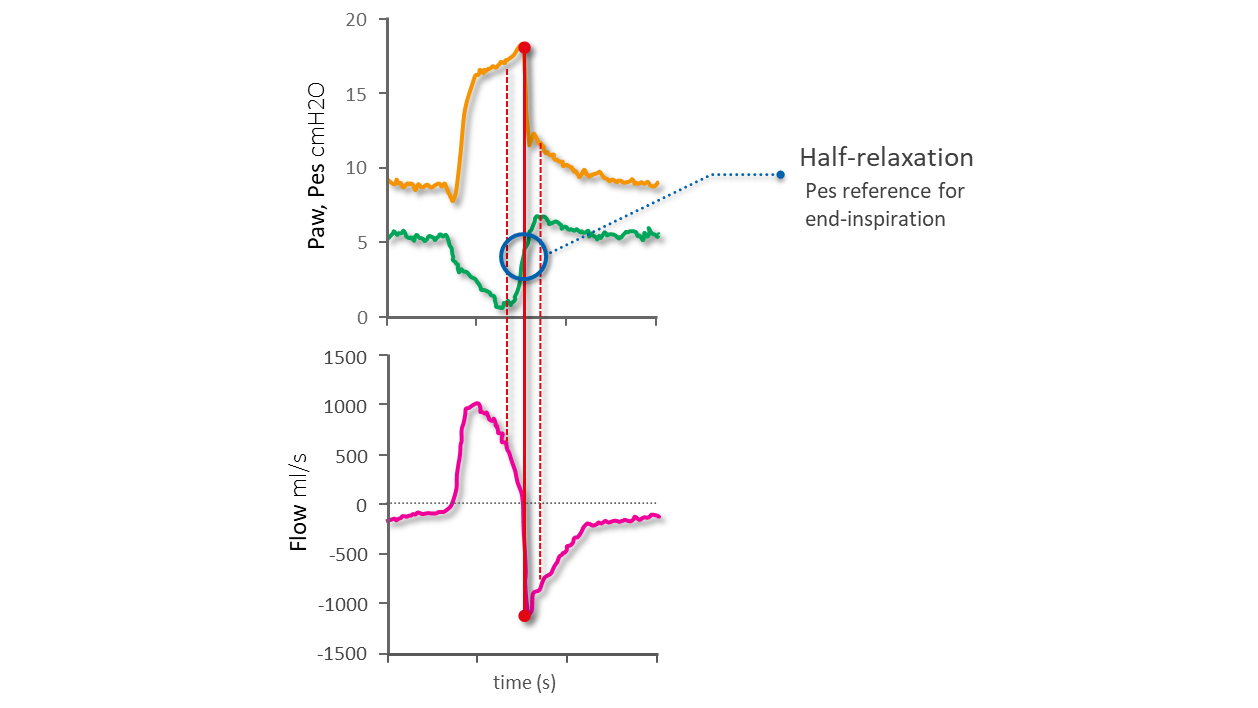 Diagrams representing pressure, flow, and Pes waveforms showing end of inspiration