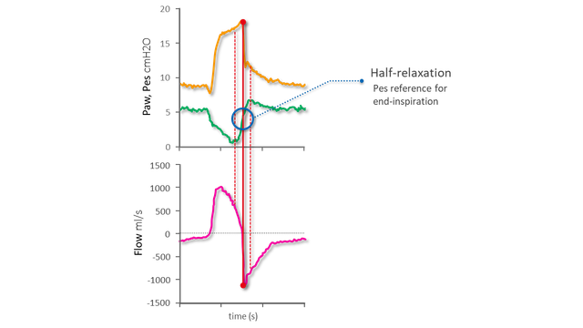 Diagrammi che rappresentano curve di pressione, flusso e Pes in cui è evidente la fine dell'inspirazione