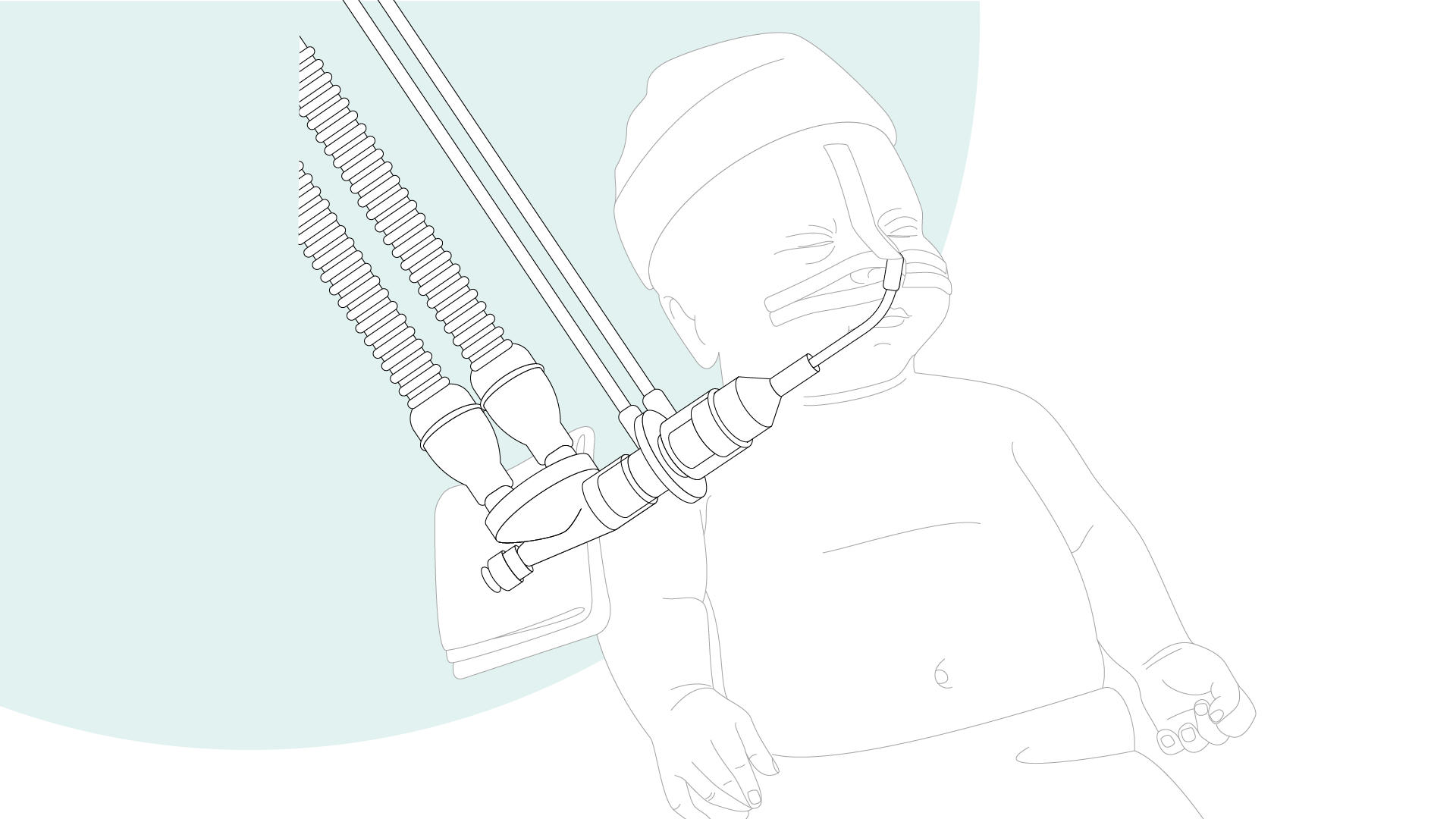 Graphic illustration: baby with flow sensor