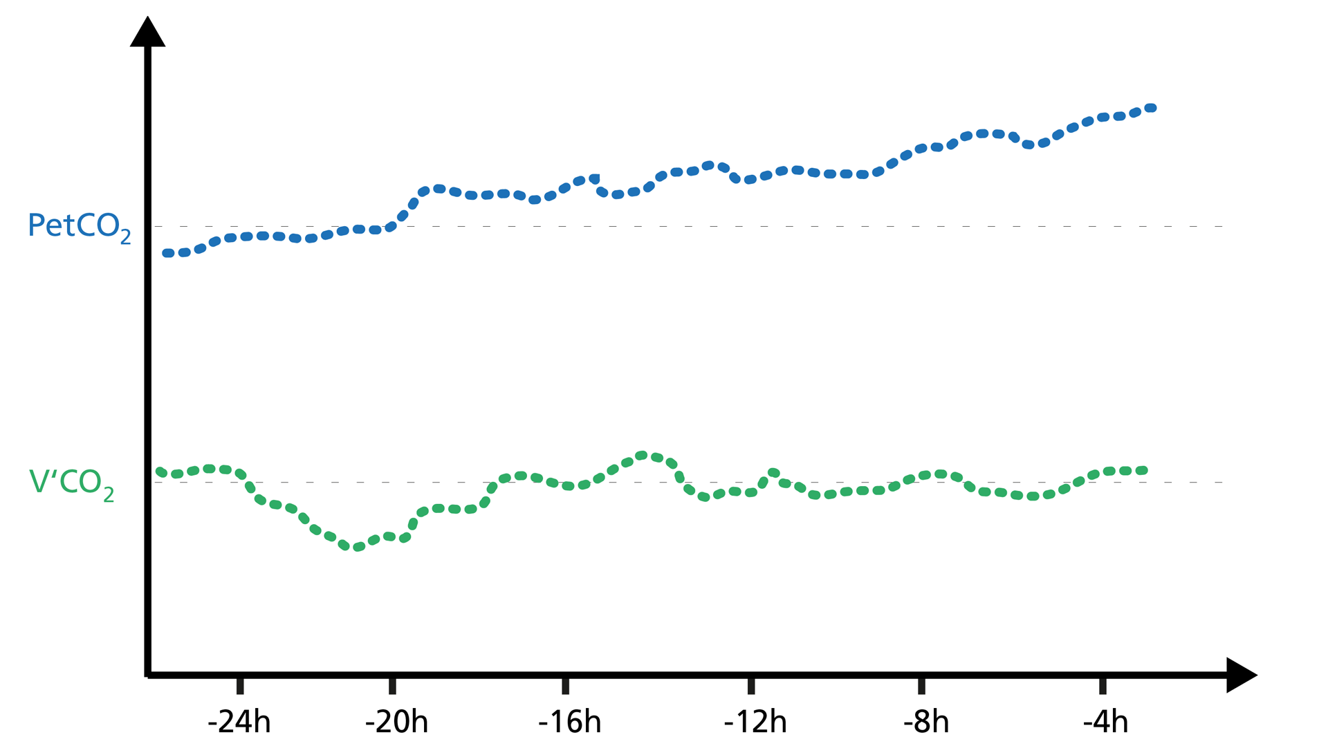 Illustration of PetCO2 versus V‘CO2 on a volumetric capnogram