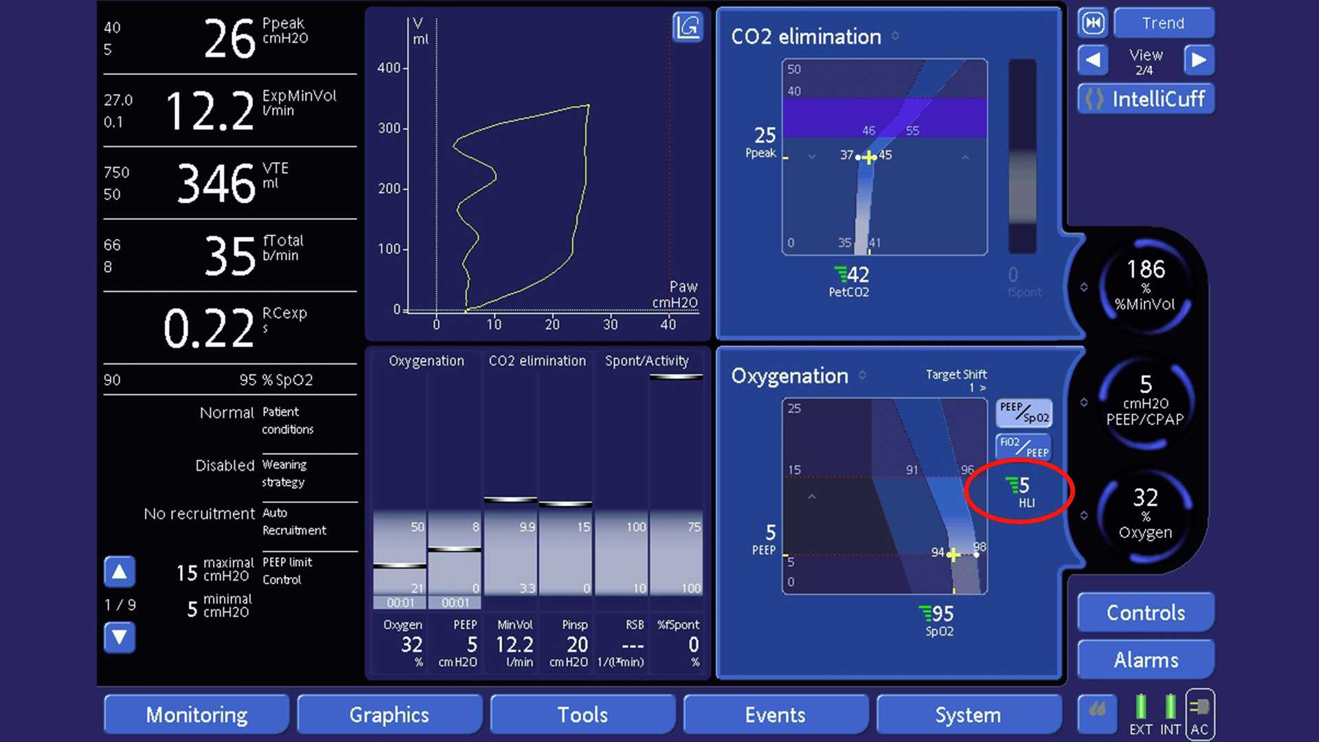 Screenshot showing HLI on Oxygenation map