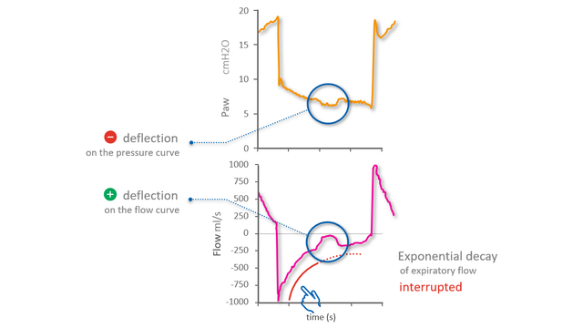 Flow and pressure waveforms with simultaneous activity