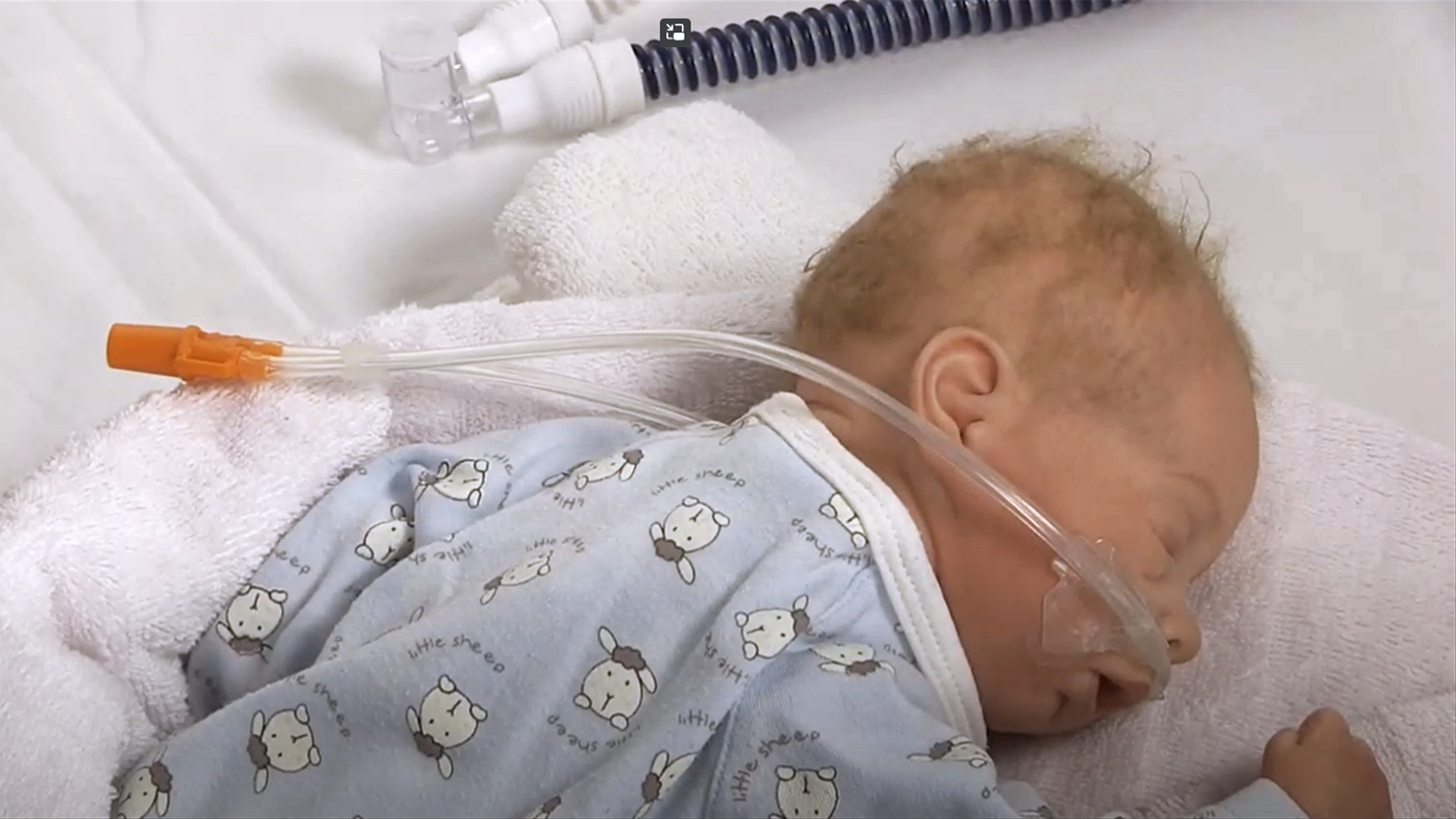 In this video we shortly demonstrate how to correctly use the Nuflow nasal cannulas. Nuflow is a patient interface for high flow oxygen therapy of neonates. 