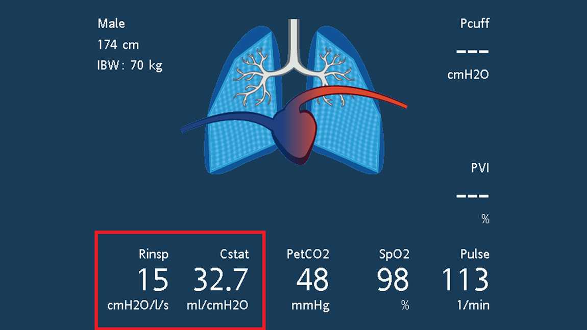 Screenshot showing dynamic lung and values for Rinsp, Cstat, and RCexp