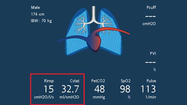 Screenshot showing dynamic lung and values for Rinsp, Cstat, and RCexp