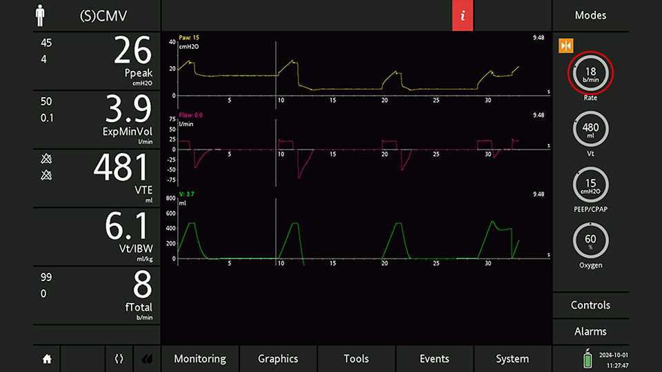 Screenshot showing screen freeze with cursor at beginning of last inspiration before the PEEP change