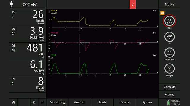 Screenshot showing screen freeze with cursor at beginning of last inspiration before the PEEP change