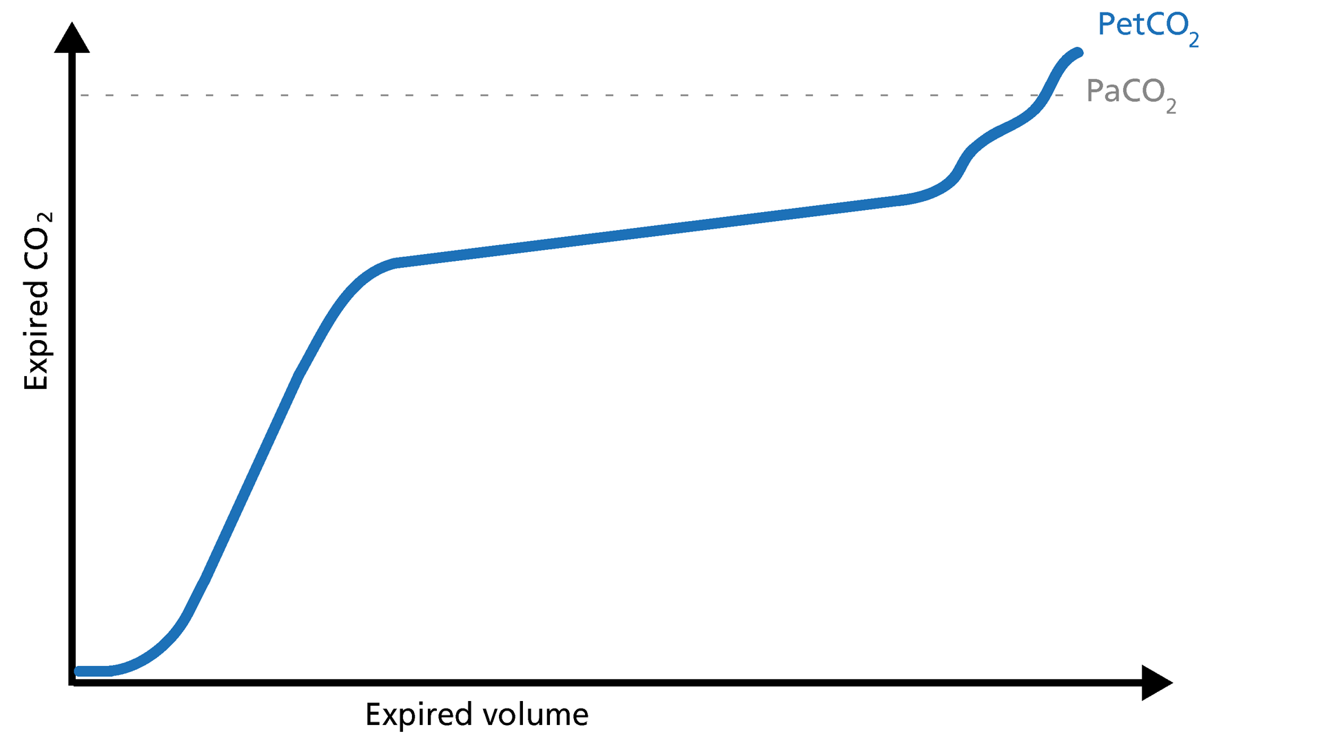 Illustration of a concave volumetric capnogram associated with obesity