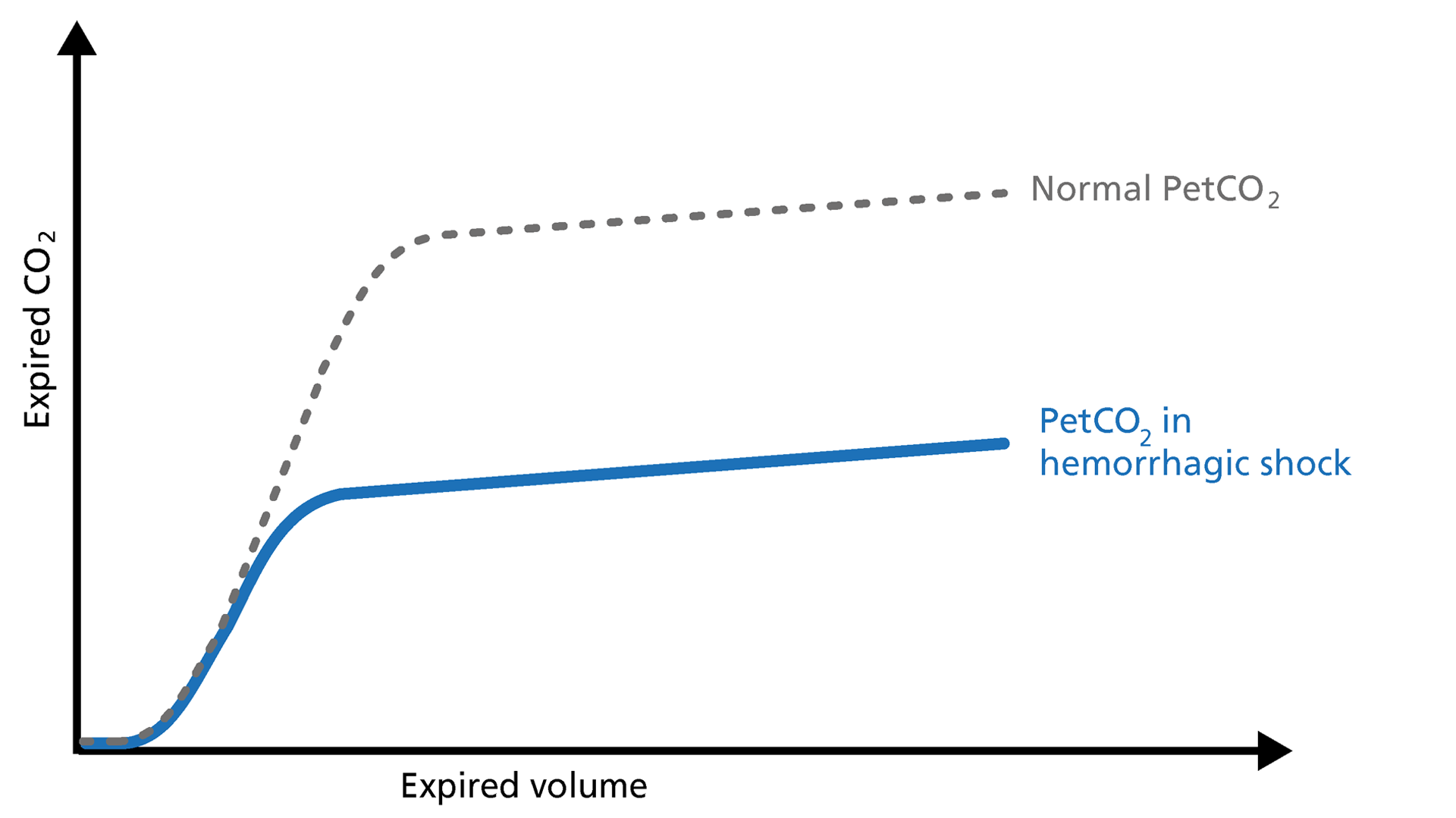 Basics Of Volumetric Capnography - Part 3: Clinical Relevance ...