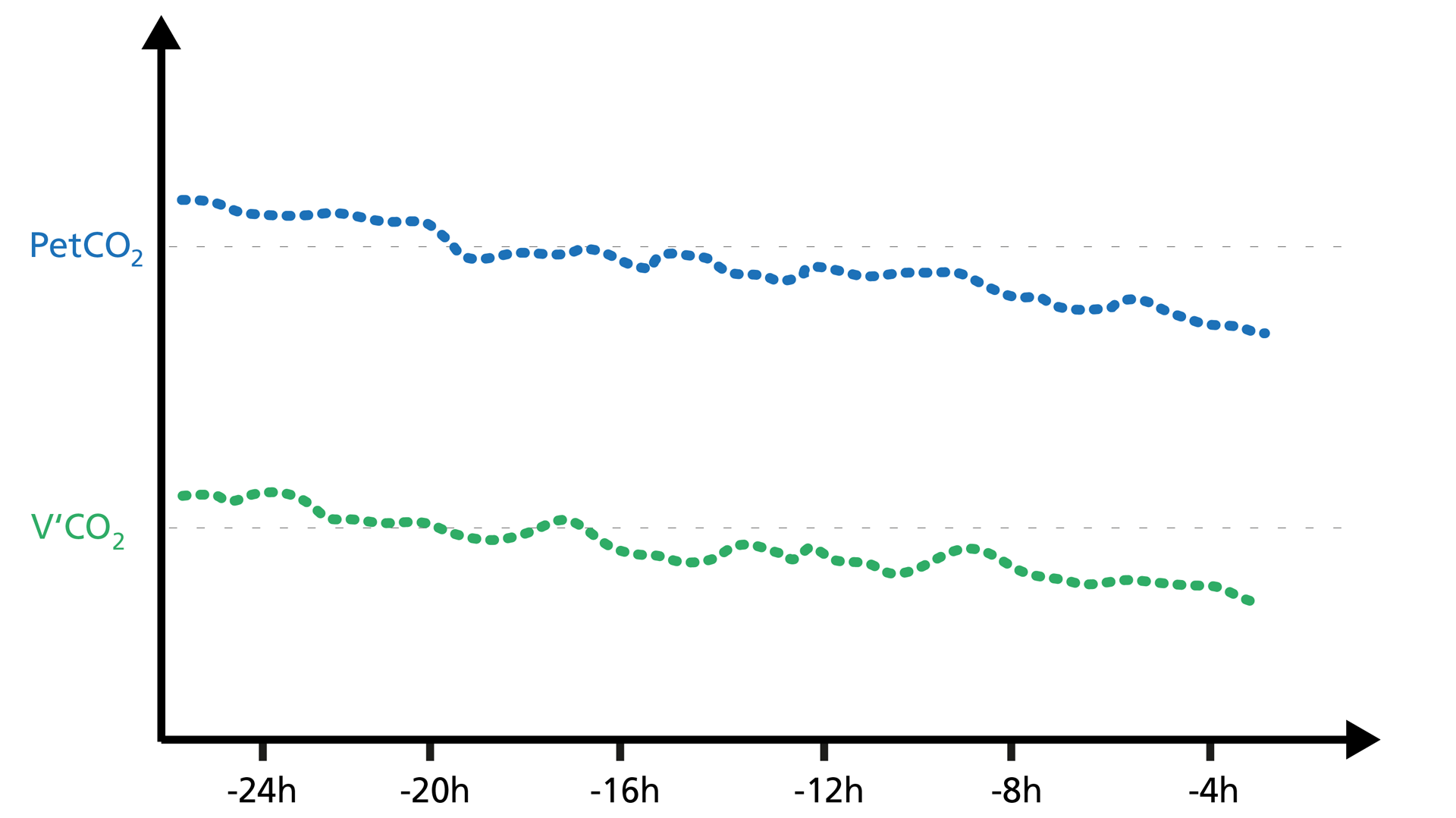 Illustration of PetCO2 versus V‘CO2 on a volumetric capnogram