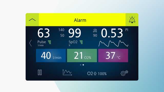 HF90_Responding_to_Alarms