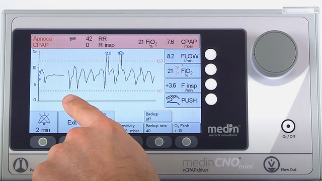 medin_Apnoea_CPAP_CNO_mini_VM_YT_Thumbnail