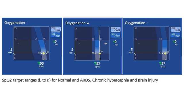 Image showing oxygenation maps for all three conditions