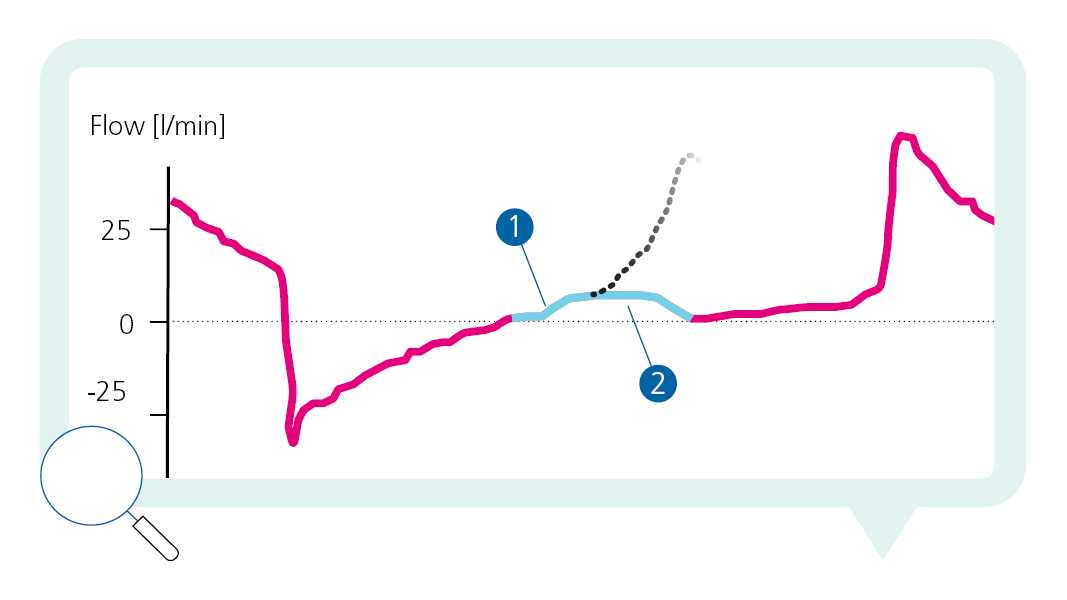 Flow waveform showing change in steepness