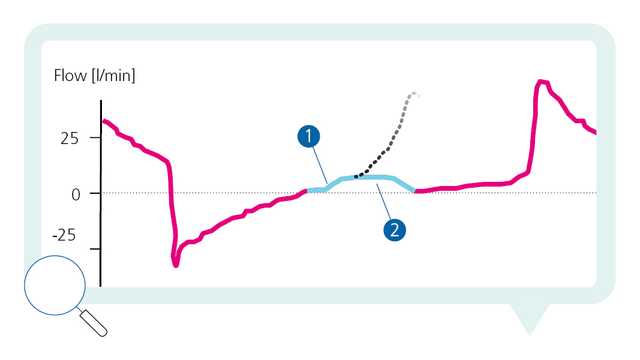 What type of asynchrony is this? #2