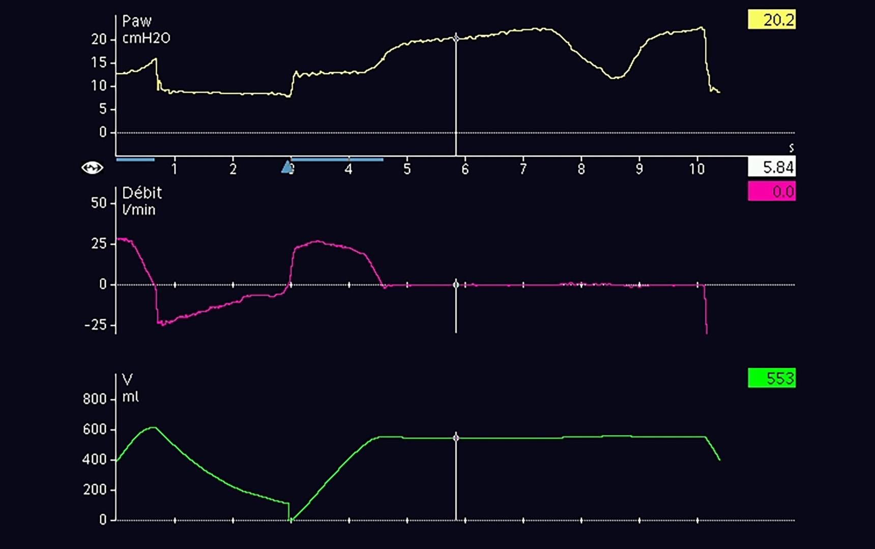 Test your IntelliVence (Vol 22 Issue 2) | Hamilton Medical