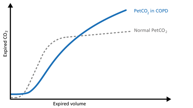 Illustration of PetCo2 in COPD patients on a volumetric capnogram