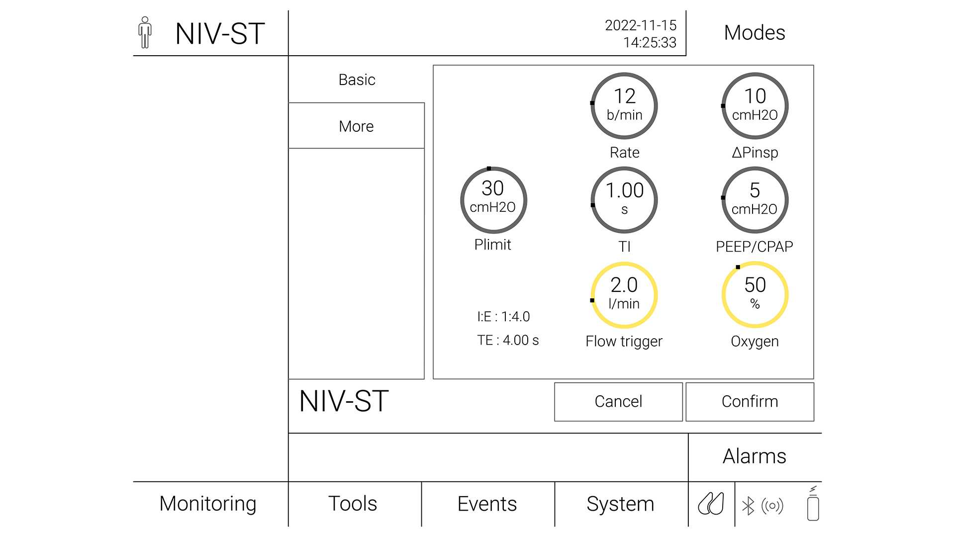 Image of ventilator settings for NIV