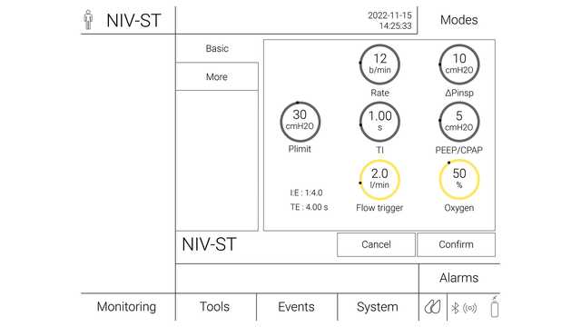 Image of ventilator settings for NIV