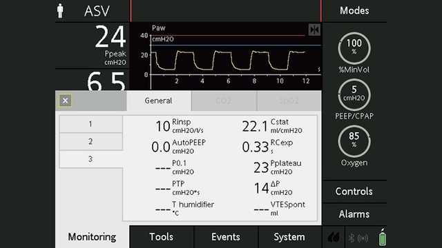 Screenshot showing monitoring window with parameters below